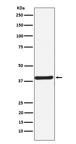 CaMKI Rabbit mAb