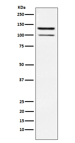 HIPK2 Rabbit mAb