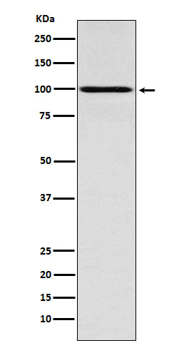 IFNGR1 Rabbit mAb