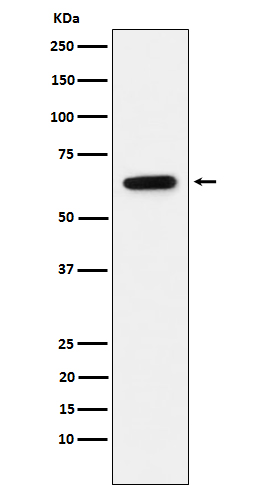 Estrogen Receptor alpha Rabbit mAb