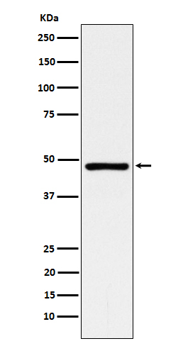 ACADM Rabbit mAb