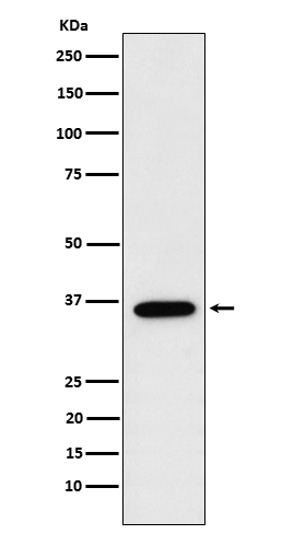 FBP1 Rabbit mAb