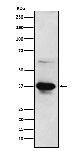 ICAD Rabbit mAb