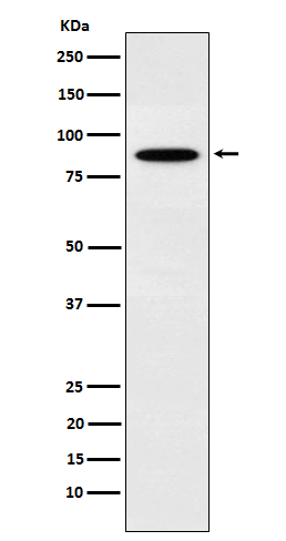 EWSR1 Rabbit mAb