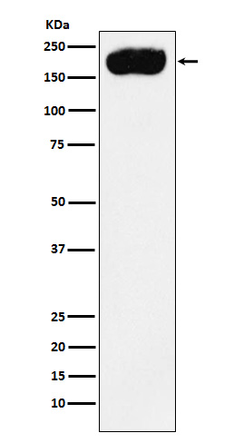 PMCA1 Rabbit mAb