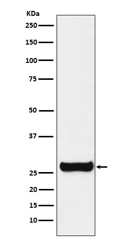 GSTM1 Rabbit mAb