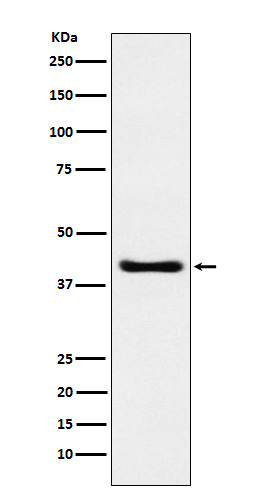 SPOP Rabbit mAb