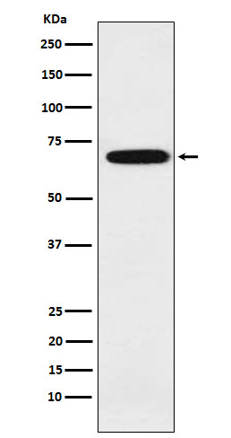 IKZF3 Rabbit mAb