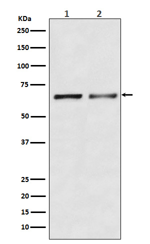 Activin Receptor Type IIB/ACVR2B Rabbit mAb