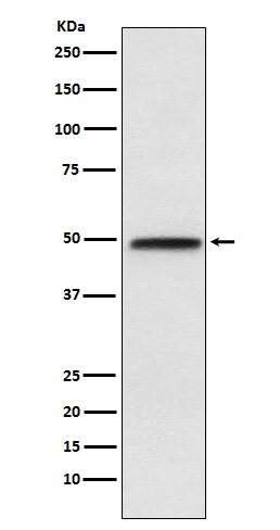 NFIB / NF1B2 Rabbit mAb