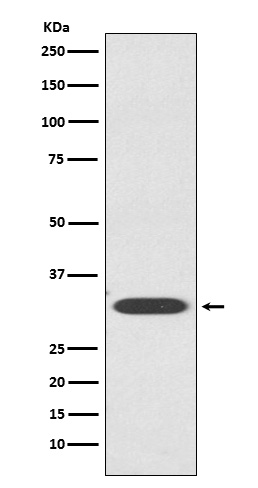 IGFBP1 Rabbit mAb