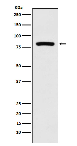 MCAK Rabbit mAb