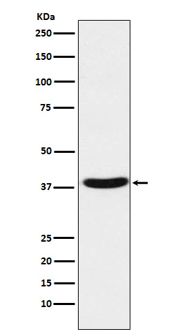 MT-ND1 Rabbit mAb