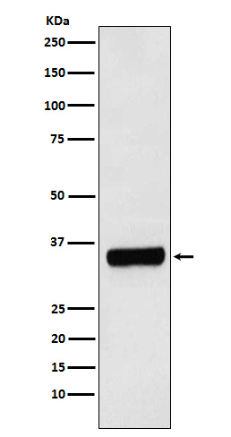 PRKRA Rabbit mAb