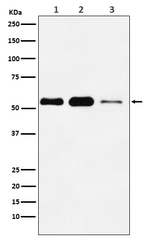 ATGL / PNPLA2 Rabbit mAb