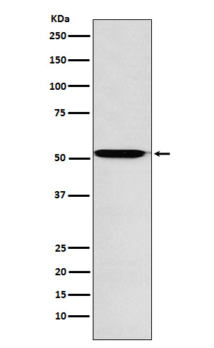 ACVR1B Rabbit mAb