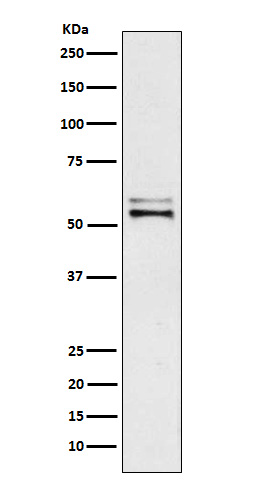 Angiotensinogen Rabbit mAb