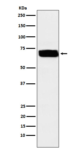 Poliovirus Receptor Rabbit mAb