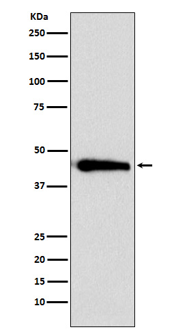 ASS1 Rabbit mAb