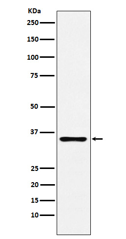 DCR2 Rabbit mAb