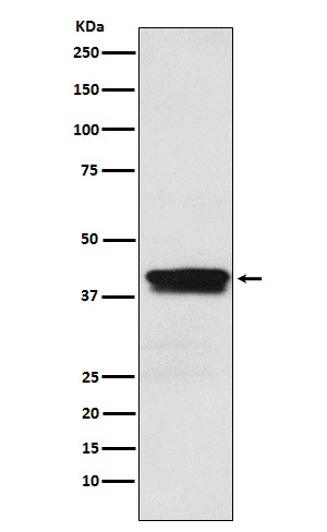 MBNL1 Rabbit mAb