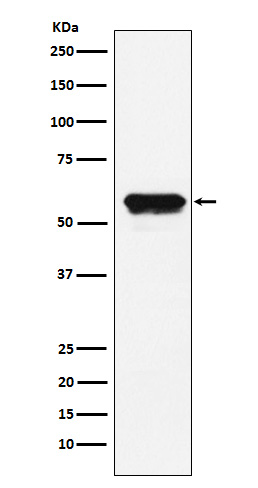 Angiotensinogen Rabbit mAb