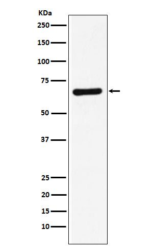 STXBP1 Rabbit mAb