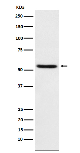 TEAD1 Rabbit mAb