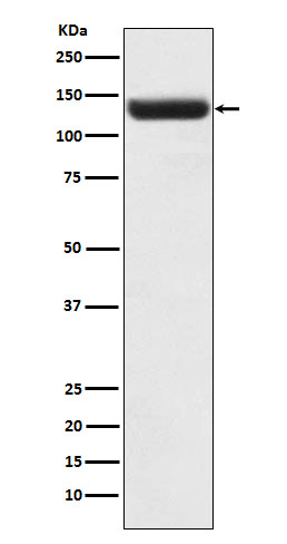 ZNF217 Rabbit mAb