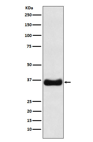 Olig1 Rabbit mAb