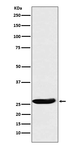 CLPP Rabbit mAb