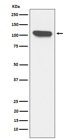 ERAP1 Rabbit mAb