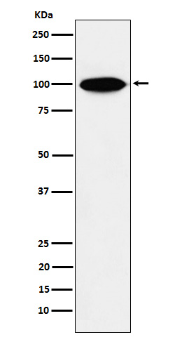 KIFAP3 Rabbit mAb