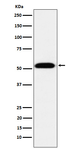 TEAD1 Rabbit mAb