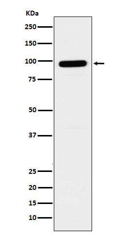 GLB1 Rabbit mAb