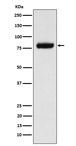 PLAP Rabbit mAb