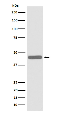 ALKBH1 Rabbit mAb