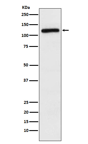 APLP2 Rabbit mAb