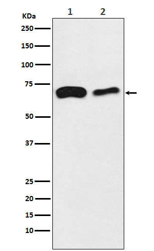 SLC27A4 / FATP4 Rabbit mAb