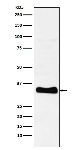 Monoacylglycerol Lipase Rabbit mAb