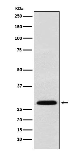 KGF Rabbit mAb