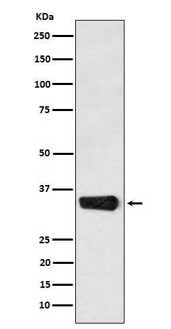 MBD3 Rabbit mAb