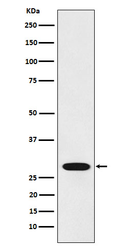 RCHY1 Rabbit mAb