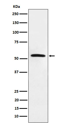 MLKL Rabbit mAb