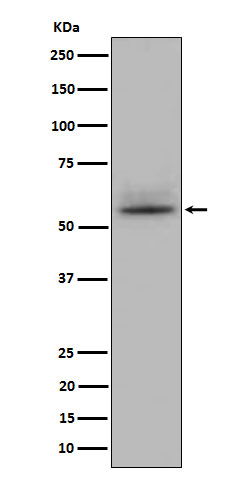 CD147 Rabbit mAb