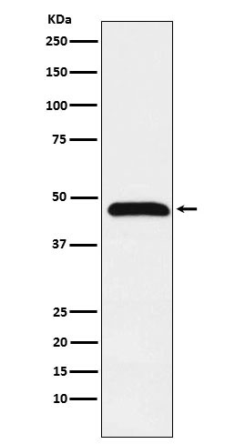 Caspase-1 Rabbit mAb