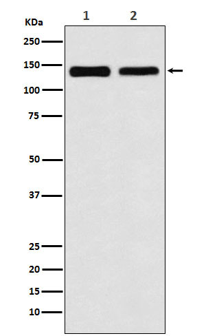 UBE4B Rabbit mAb