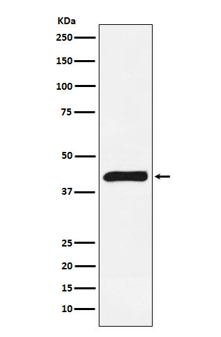 ALKBH1 Rabbit mAb