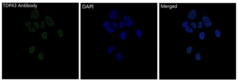 TDP43 Rabbit mAb