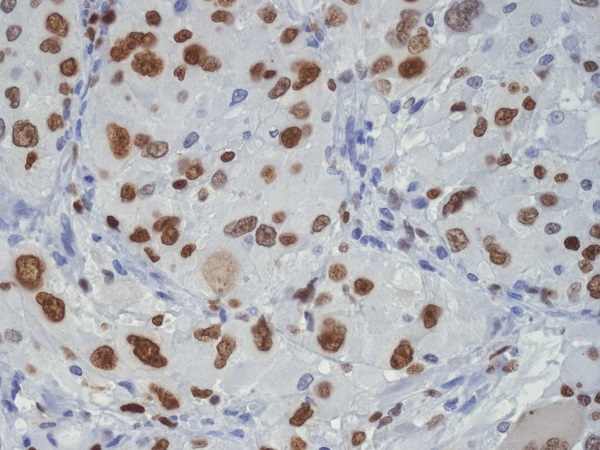 TDP43 Rabbit mAb